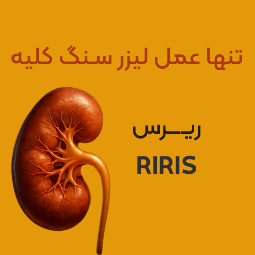 تنها عمل لیزر سنگ کلیه ریرس